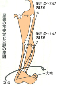 府中・調布で美脚矯正を受ける様子
