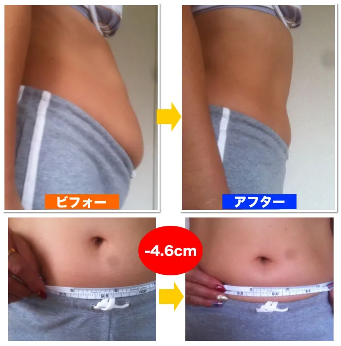 mさんの骨盤矯正ビフォーアフター
